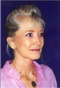 Face & Neck Lift: after surgery